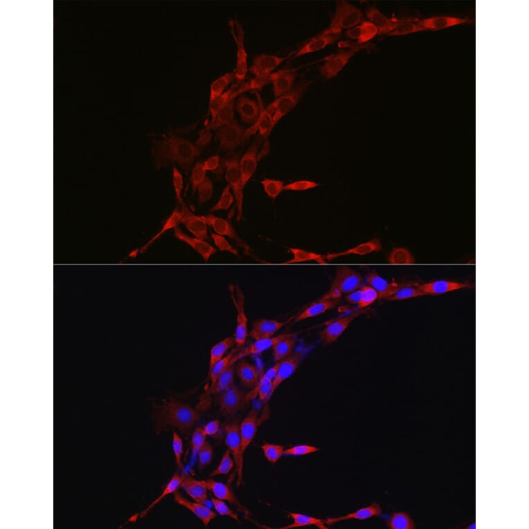 Immunofluorescence - Anti-Cyclin B1 Antibody (A90461) - Antibodies.com