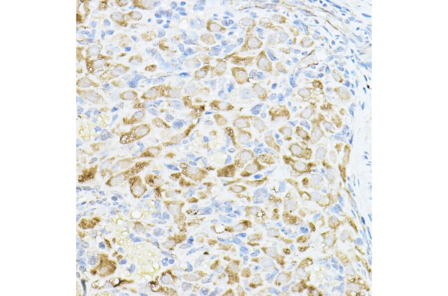 Immunohistochemistry - Anti-Cyclin B1 Antibody (A90462) - Antibodies.com