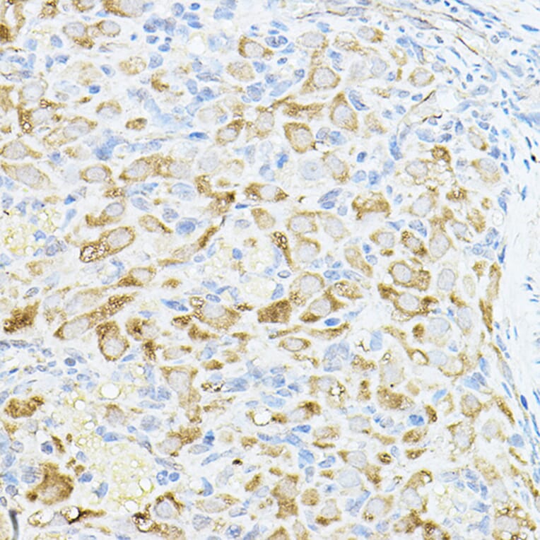 Immunohistochemistry - Anti-Cyclin B1 Antibody (A90462) - Antibodies.com