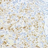 Immunohistochemistry - Anti-Cyclin B1 Antibody (A90462) - Antibodies.com