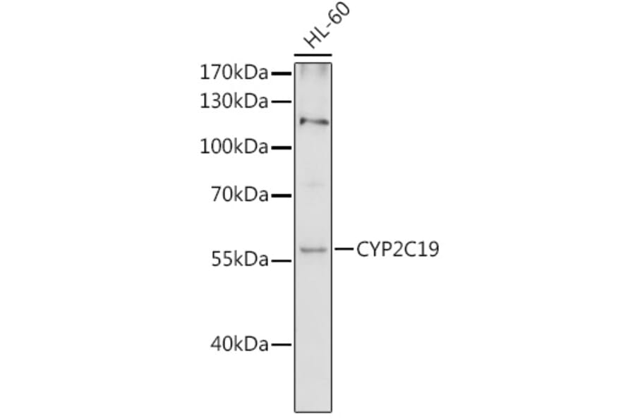 Western Blot - Anti-CYP2C19 Antibody (A16313) - Antibodies.com