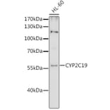 Western Blot - Anti-CYP2C19 Antibody (A16313) - Antibodies.com