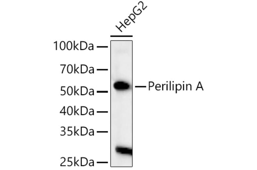 Western Blot - Anti-Perilipin-1 Antibody (A90464) - Antibodies.com