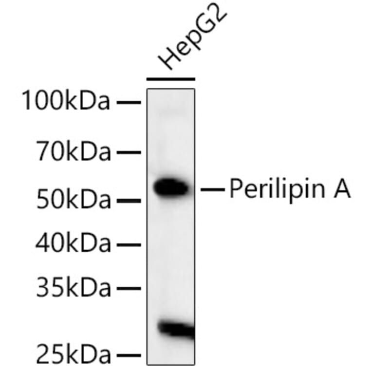 Western Blot - Anti-Perilipin-1 Antibody (A90464) - Antibodies.com