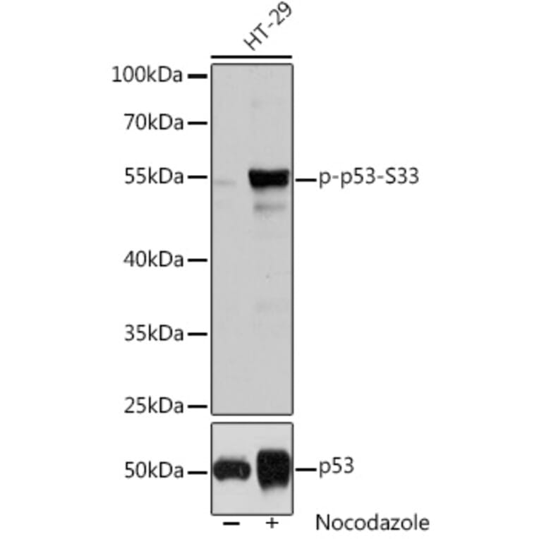 Western Blot - Anti-p53 (phospho Ser33) Antibody (A90465) - Antibodies.com