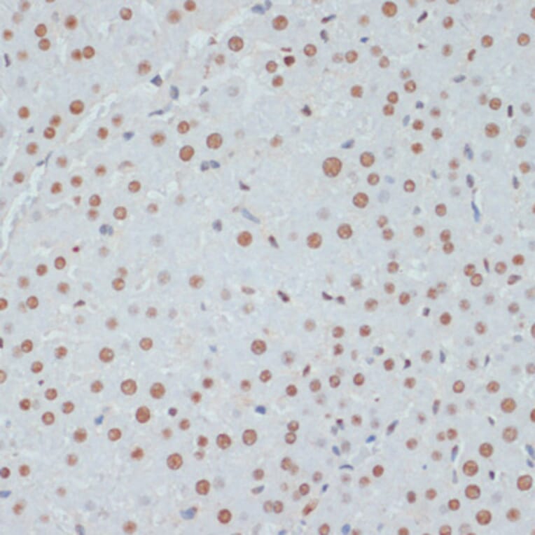 Immunohistochemistry - Anti-p53 (phospho Ser33) Antibody (A90465) - Antibodies.com