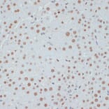 Immunohistochemistry - Anti-p53 (phospho Ser33) Antibody (A90465) - Antibodies.com