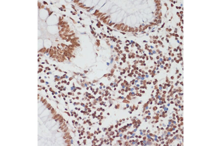 Immunohistochemistry - Anti-p53 (phospho Ser33) Antibody (A90465) - Antibodies.com