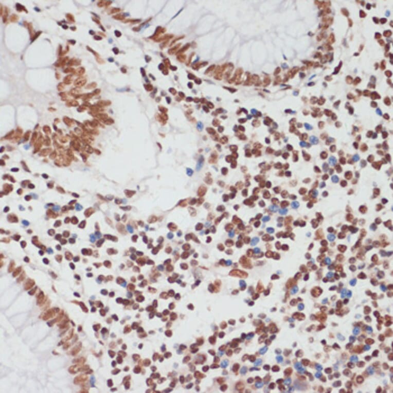 Immunohistochemistry - Anti-p53 (phospho Ser33) Antibody (A90465) - Antibodies.com