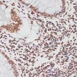Immunohistochemistry - Anti-p53 (phospho Ser33) Antibody (A90465) - Antibodies.com