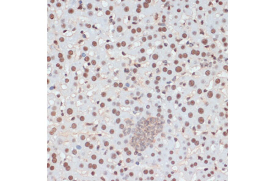 Immunohistochemistry - Anti-p53 (phospho Ser33) Antibody (A90465) - Antibodies.com