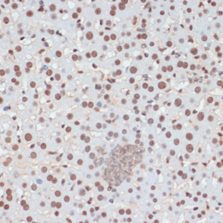 Immunohistochemistry - Anti-p53 (phospho Ser33) Antibody (A90465) - Antibodies.com