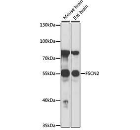 Western Blot - Anti-Fascin 2 Antibody (A90466) - Antibodies.com