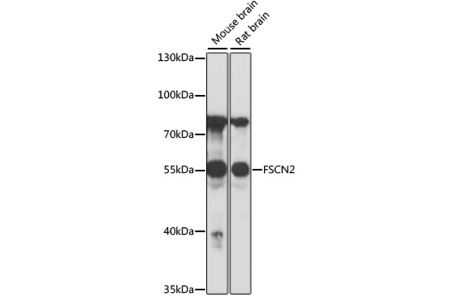Western Blot - Anti-Fascin 2 Antibody (A90466) - Antibodies.com