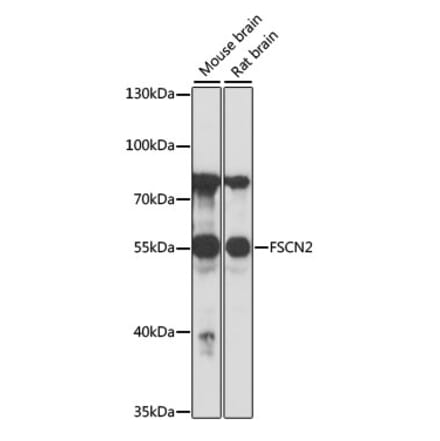 Western Blot - Anti-Fascin 2 Antibody (A90466) - Antibodies.com