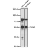 Western Blot - Anti-Fascin 2 Antibody (A90466) - Antibodies.com