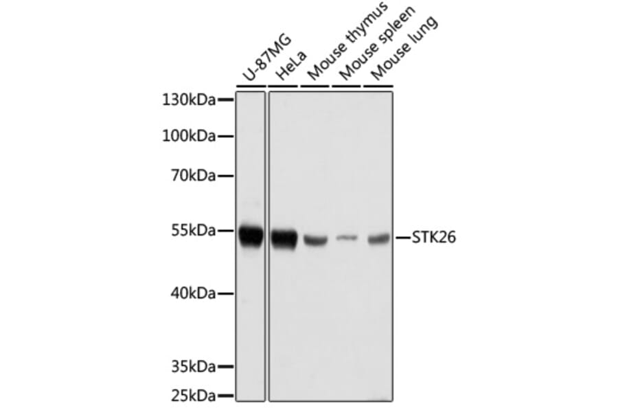 Western Blot - Anti-MST4 Antibody (A90467) - Antibodies.com