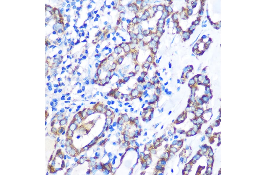 Immunohistochemistry - Anti-MST4 Antibody (A90467) - Antibodies.com