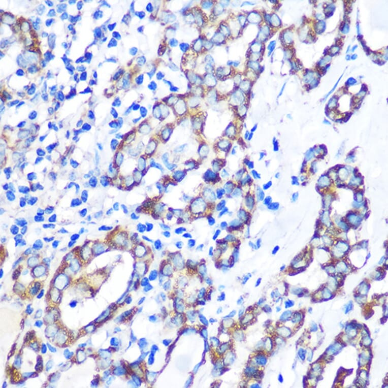 Immunohistochemistry - Anti-MST4 Antibody (A90467) - Antibodies.com