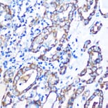 Immunohistochemistry - Anti-MST4 Antibody (A90467) - Antibodies.com