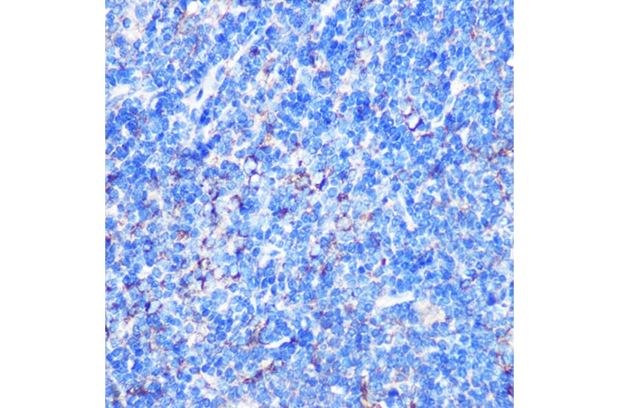 Immunohistochemistry - Anti-MST4 Antibody (A90467) - Antibodies.com