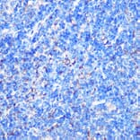 Immunohistochemistry - Anti-MST4 Antibody (A90467) - Antibodies.com