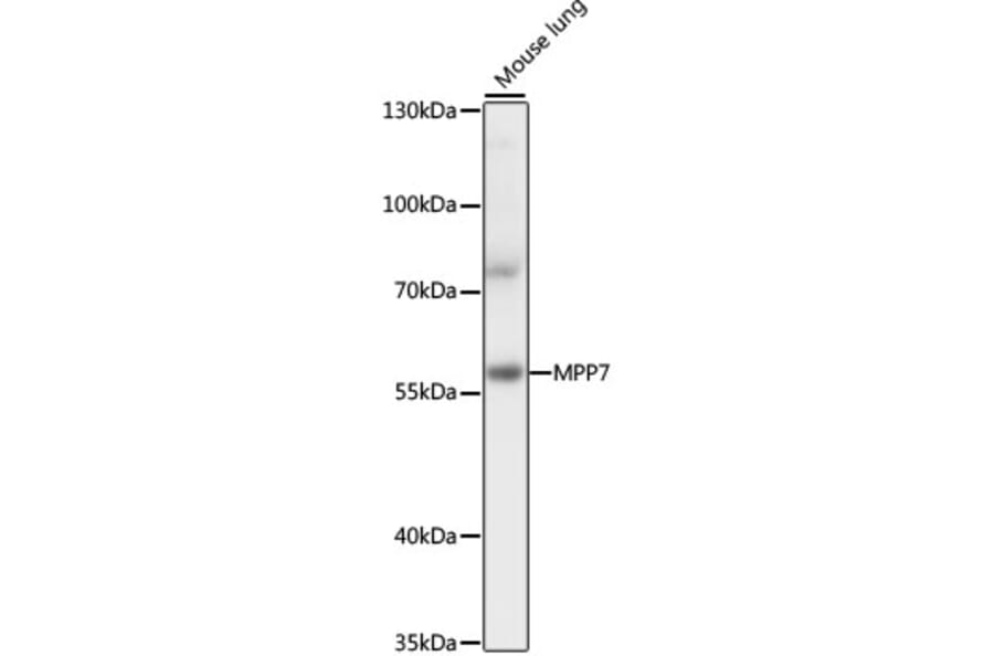 Western Blot - Anti-MPP7 Antibody (A90468) - Antibodies.com