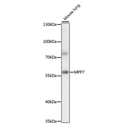 Western Blot - Anti-MPP7 Antibody (A90468) - Antibodies.com