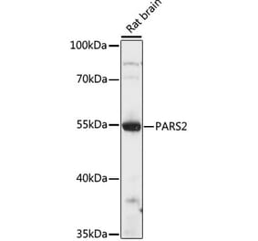 Western Blot - Anti-PARS2 Antibody (A90469) - Antibodies.com