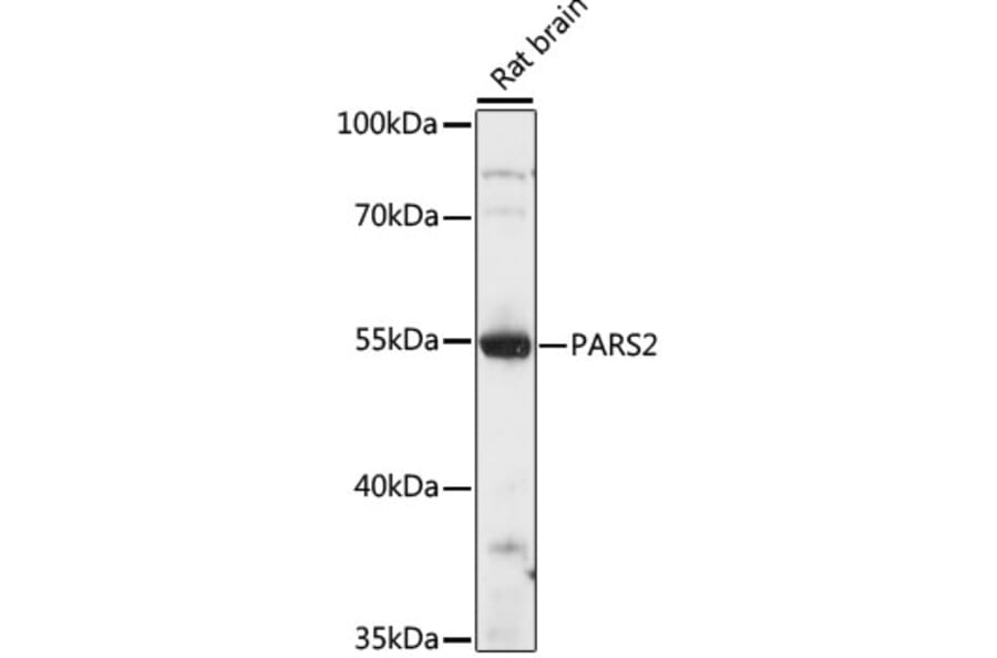 Western Blot - Anti-PARS2 Antibody (A90469) - Antibodies.com