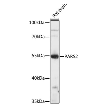 Western Blot - Anti-PARS2 Antibody (A90469) - Antibodies.com