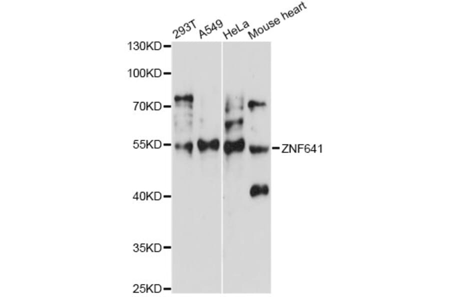Western Blot - Anti-ZNF641 Antibody (A14438) - Antibodies.com