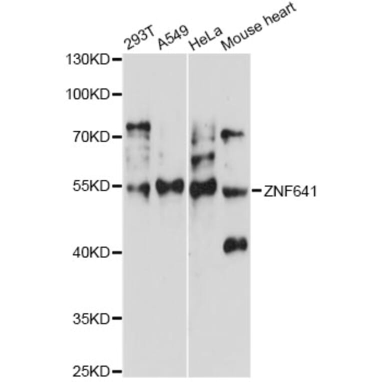 Western Blot - Anti-ZNF641 Antibody (A14438) - Antibodies.com