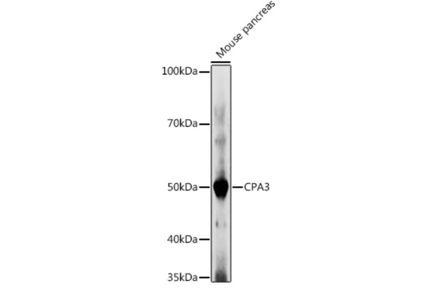 Western Blot - Anti-CPA3 Antibody (A90471) - Antibodies.com