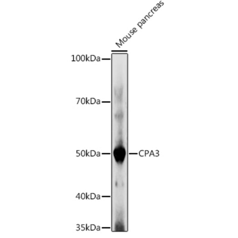 Western Blot - Anti-CPA3 Antibody (A90471) - Antibodies.com