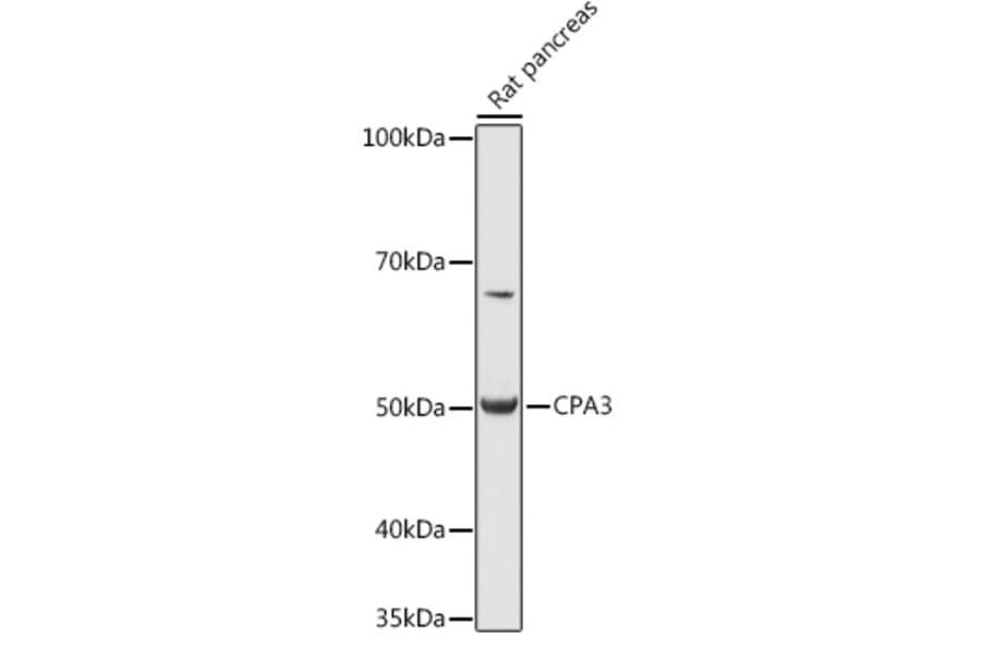 Western Blot - Anti-CPA3 Antibody (A90471) - Antibodies.com