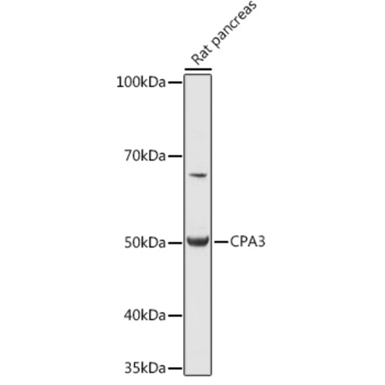 Western Blot - Anti-CPA3 Antibody (A90471) - Antibodies.com