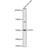 Western Blot - Anti-CPA3 Antibody (A90471) - Antibodies.com