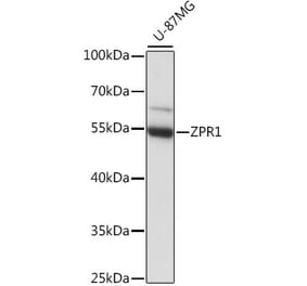 Western Blot - Anti-ZPR1 Antibody (A90472) - Antibodies.com