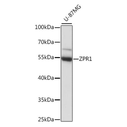 Western Blot - Anti-ZPR1 Antibody (A90472) - Antibodies.com