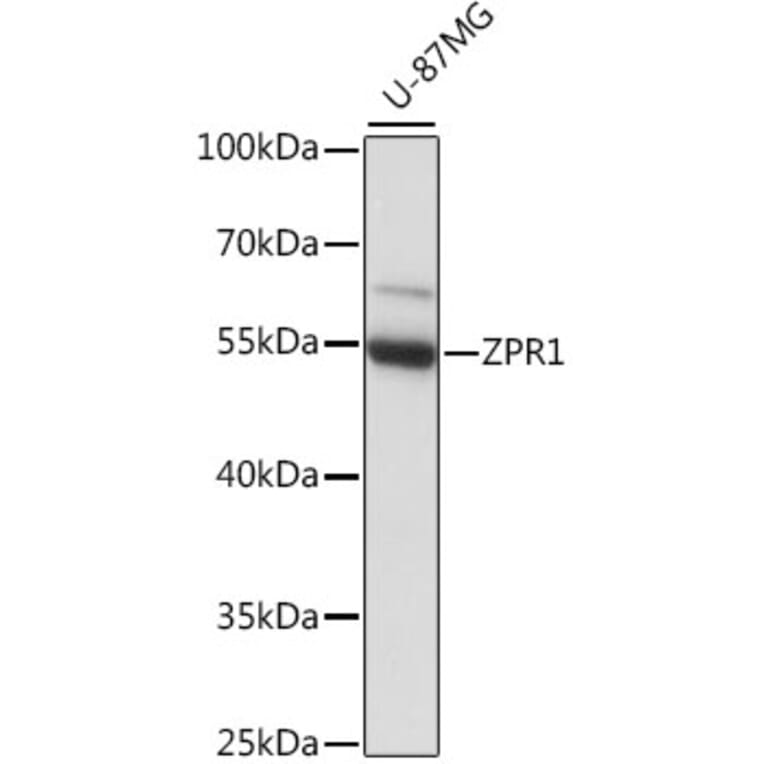 Western Blot - Anti-ZPR1 Antibody (A90472) - Antibodies.com