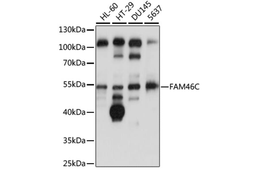 Western Blot - Anti-FAM46C Antibody (A90473) - Antibodies.com