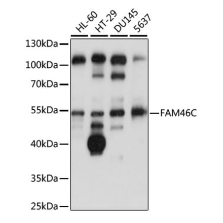 Western Blot - Anti-FAM46C Antibody (A90473) - Antibodies.com