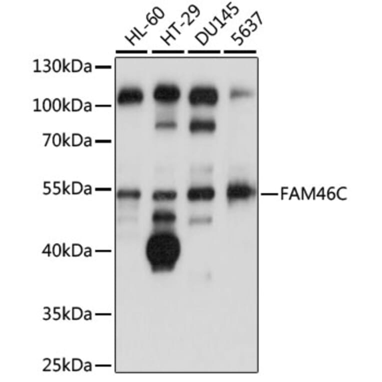 Western Blot - Anti-FAM46C Antibody (A90473) - Antibodies.com