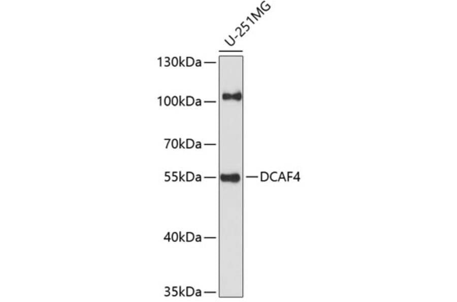 Western Blot - Anti-WDR21A Antibody (A90474) - Antibodies.com