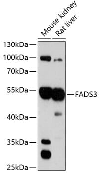 Western blot analysis of extracts of various cell lines, using Anti-FADS3 Antibody (A3947) at 1:3000 dilution.
Secondary antibody: Goat Anti-Rabbit IgG (H+L) (HRP) (AS014) at 1:10,000 dilution.
Lysates / proteins: 25µg per lane.
Blocking buffer: 3% non-fat dry milk in TBST.
Detection: ECL Basic Kit (RM00020).
Exposure time: 90s.