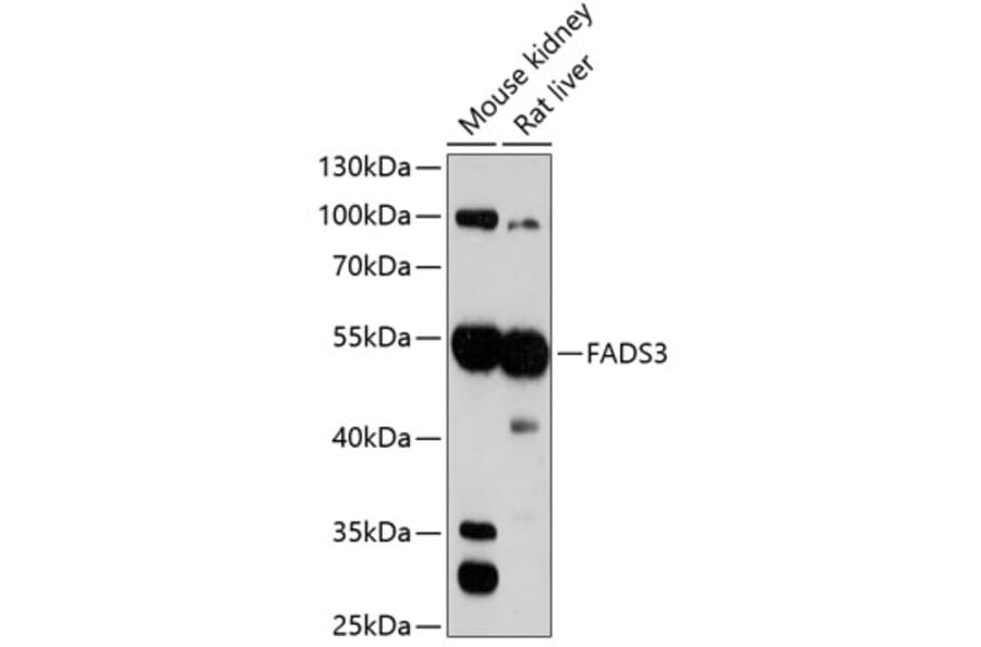 Western Blot - Anti-FADS3 Antibody (A90475) - Antibodies.com
