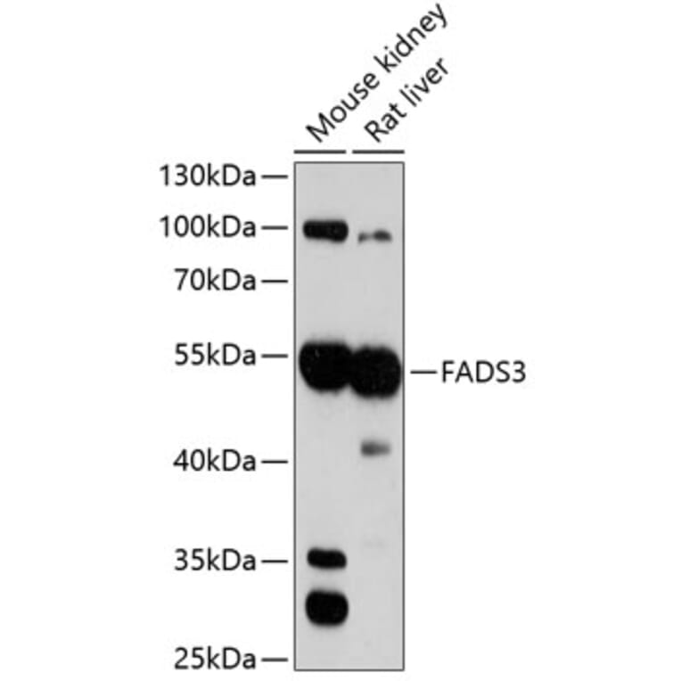 Western Blot - Anti-FADS3 Antibody (A90475) - Antibodies.com