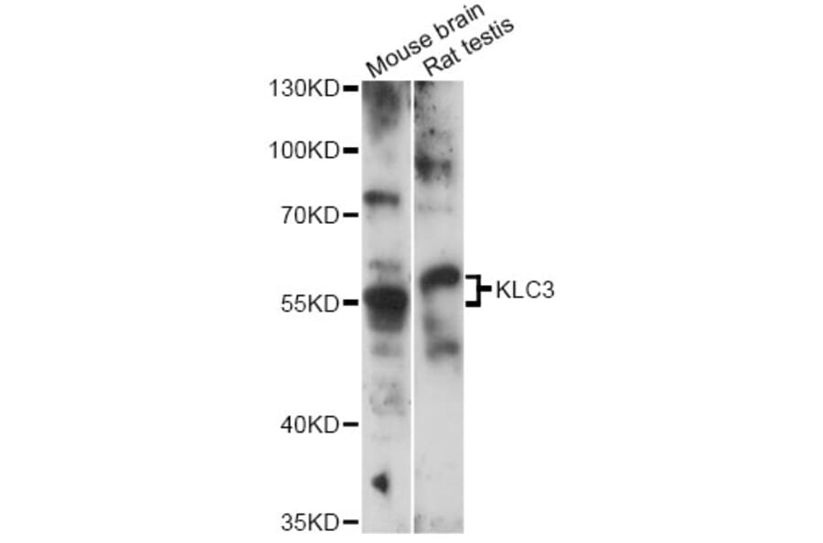 Western Blot - Anti-KLC3 Antibody (A14341) - Antibodies.com
