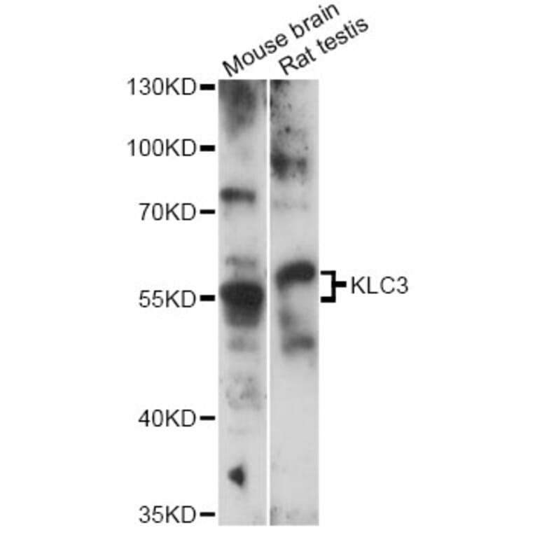 Western Blot - Anti-KLC3 Antibody (A14341) - Antibodies.com